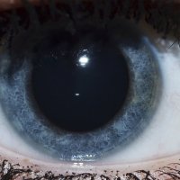 Eye :: Иван Ничипорович