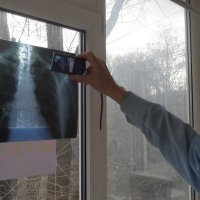 Рентген показал, что пациент скорее жив и частично трезвый... :: Alex Aro Aro Алексей Арошенко