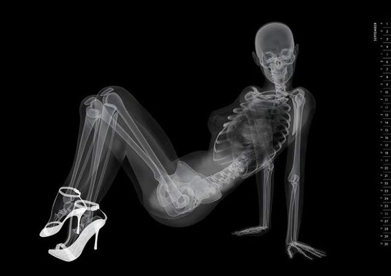 Рентген и девушки - смотрите необычные фото