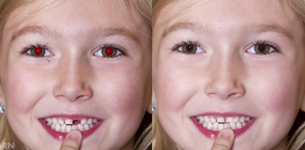 Как удалить красные глаза и добавить зуб с помощью Photoshop