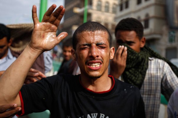 AP Photo/Hani Mohammed