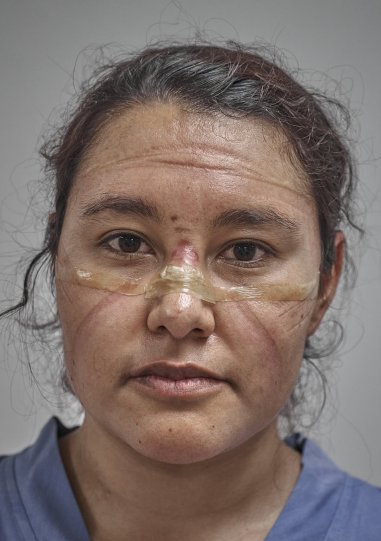 2 место в категории «Портреты», 2021. Доктор в конце смены со следами от защитной маски, Мехико, Мексика, 19 мая 2020 года. Автор Иван Масиас.