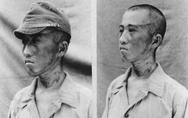 Новости в фотографиях - страшные кадры в память о Хиросиме - №16
