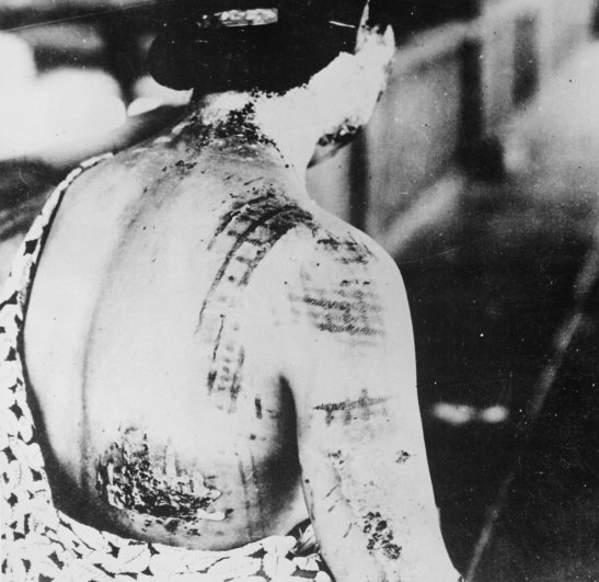 Новости в фотографиях - страшные кадры в память о Хиросиме - №24