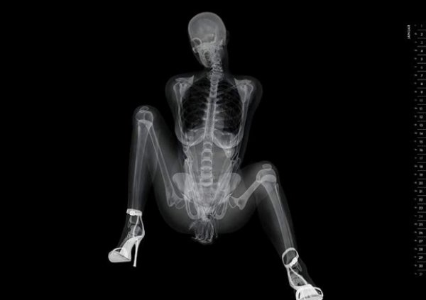Рентген и девушки - смотрите необычные фото - №1