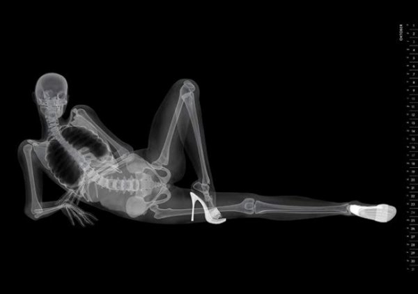 Рентген и девушки - смотрите необычные фото - №2