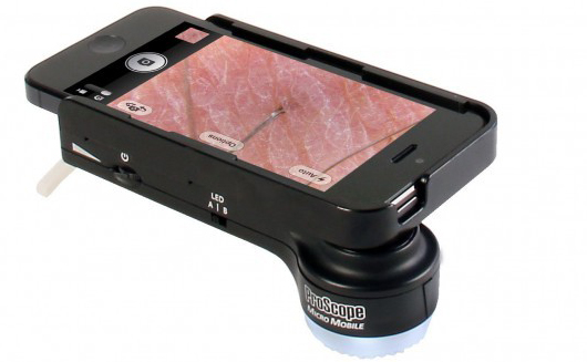 Лучшее для iPhone - микроскоп ProScope Micro Mobile