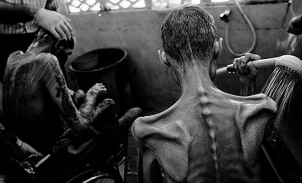 История одной фотографии - В борьбе за жизнь